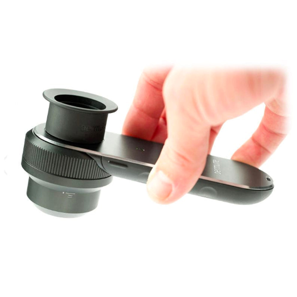 DermLite Dermatoscope DL3N with PigmentBoost