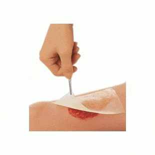 Smith & Nephew Cuticerin Low Adherent Impregnated Gauze Dressing