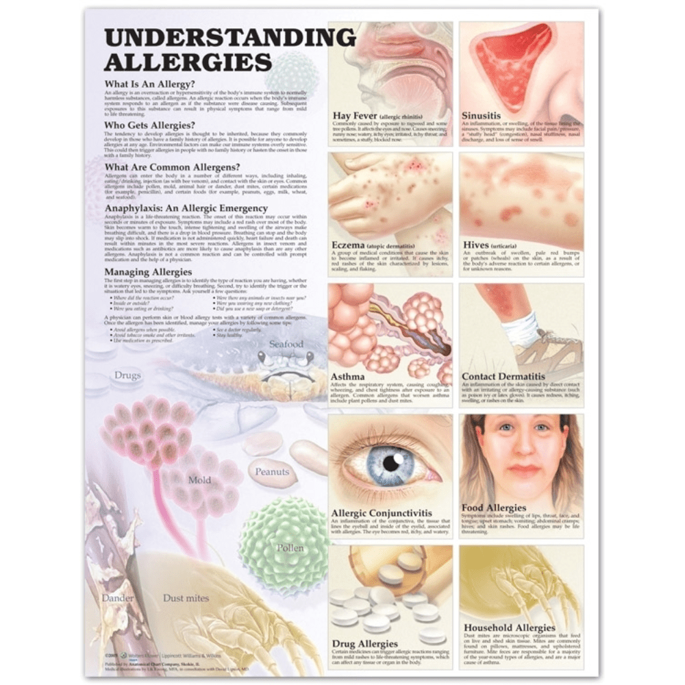 Understanding Allergies Anatomical Chart