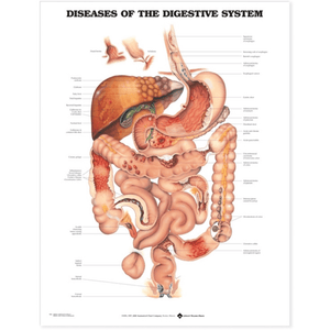 Diseases of the Digestive System Anatomical Chart