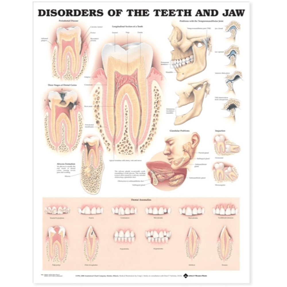 Disorders of the Teeth and Jaw Anatomical Chart