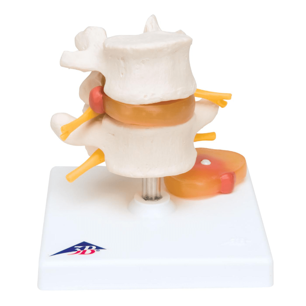 Lumbar Vertebrae Teaching Model