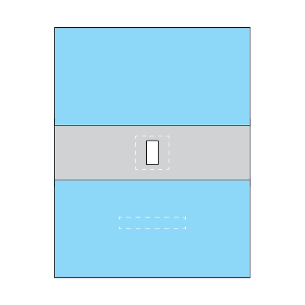 Multigate Drapes & Equipment Covers Epidural Drape Clear Adhesive Aperture / 100cm x 128cm / Sterile Multigate Drape