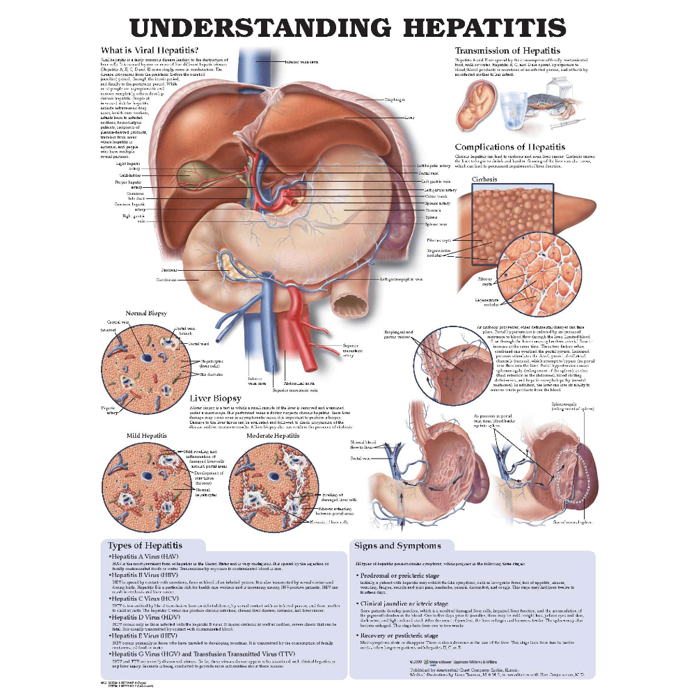 Understanding Hepatitis Anatomical Chart