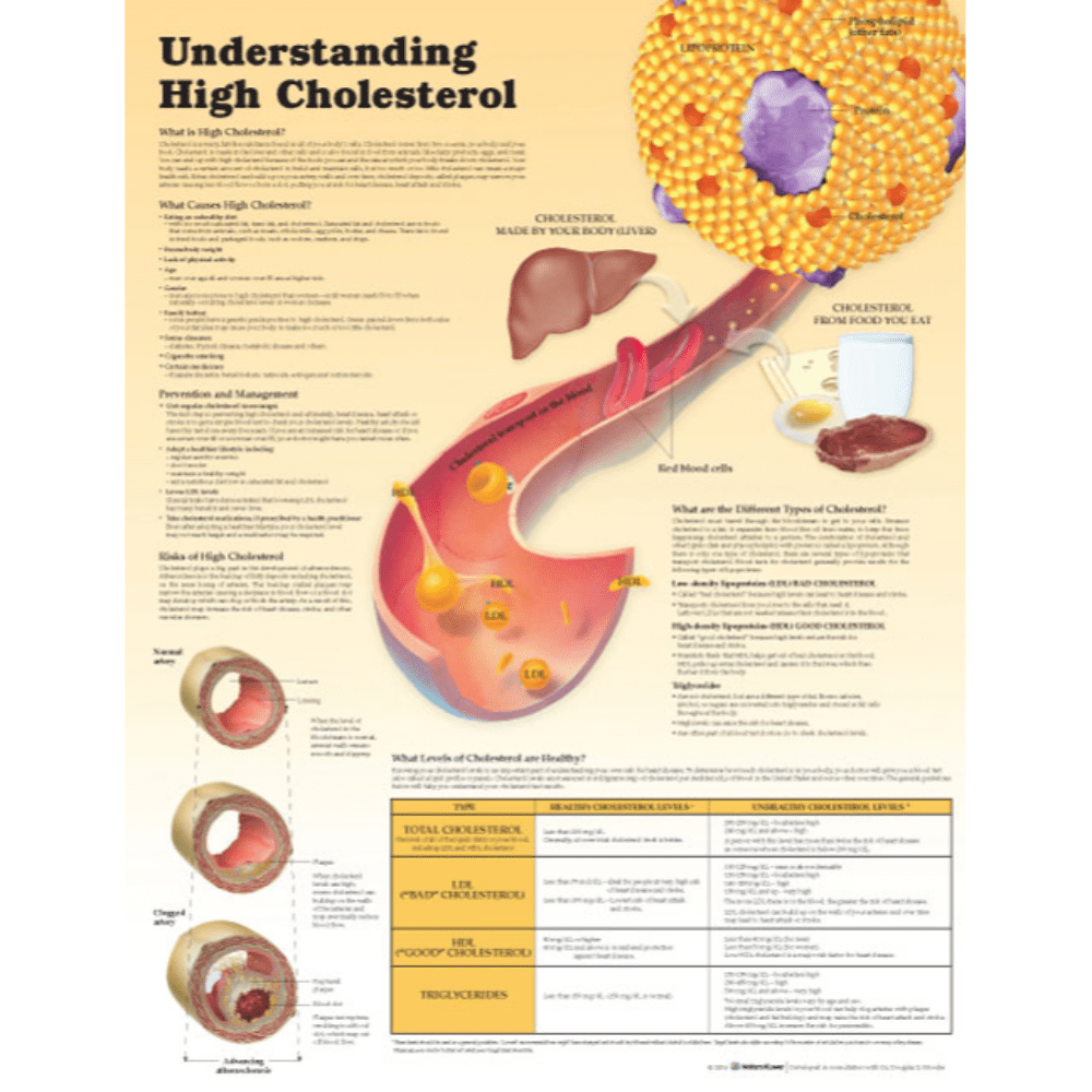 Understanding High Cholesterol Paper  None  Paper