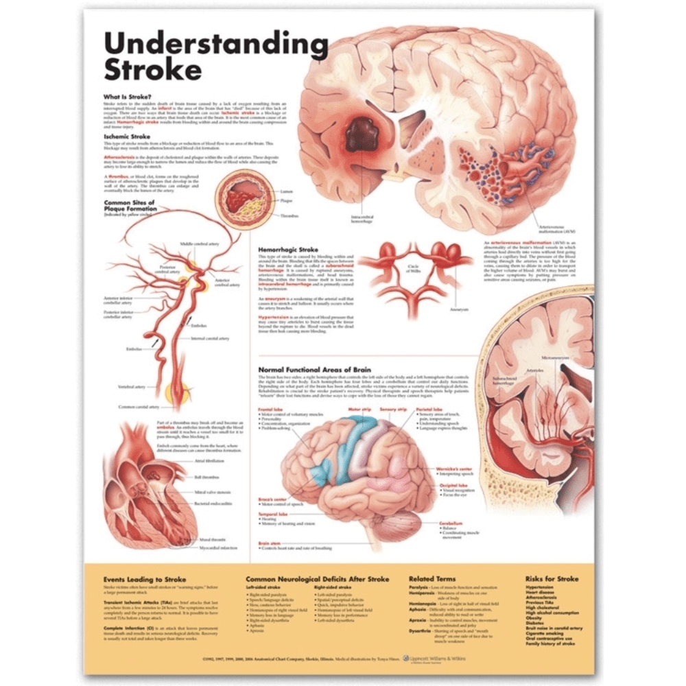 thumbnail image 2 of Anatomy Lab Human Brain Anatomy Poster, LAMINATED, Hungary 2 of 12